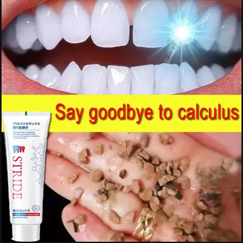 Dental Cálculo removedor branqueamento dentário dentes dentífrico, boca odor remoção, mau hálito placa, prevenindo a periodontite