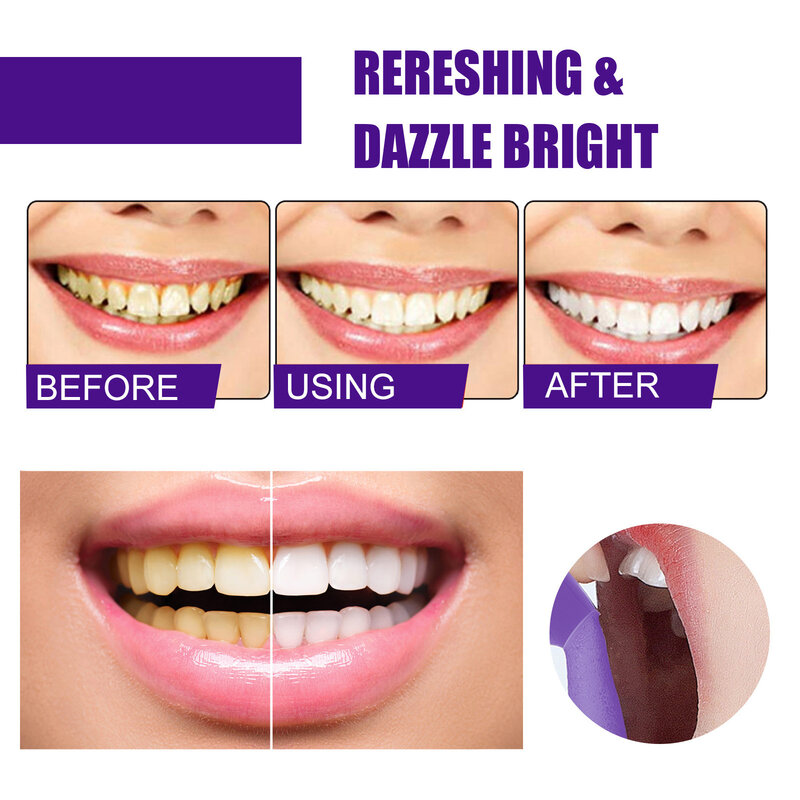 Jaysuing-口腔洗浄歯磨き粉,白,黄色の歯のホワイトニング,汚れの除去,v34