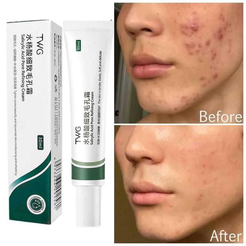 Salicylsäure Poren Raffination Creme Schrumpf poren verbessern Gesicht Akne Mitesser entfernen Creme Anti-Aging-Öl Kontrolle Hautpflege 20ml