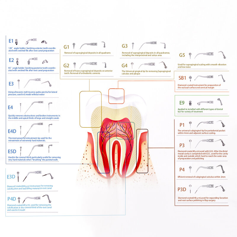 رأس قشارة الأسنان بالموجات فوق الصوتية ، نقار الخشب المناسب ، قبضة EMS ، التحجيم ، G1 ، G2 ، G3 ، G4 ، P1 ، P3 ، E1 ، E2