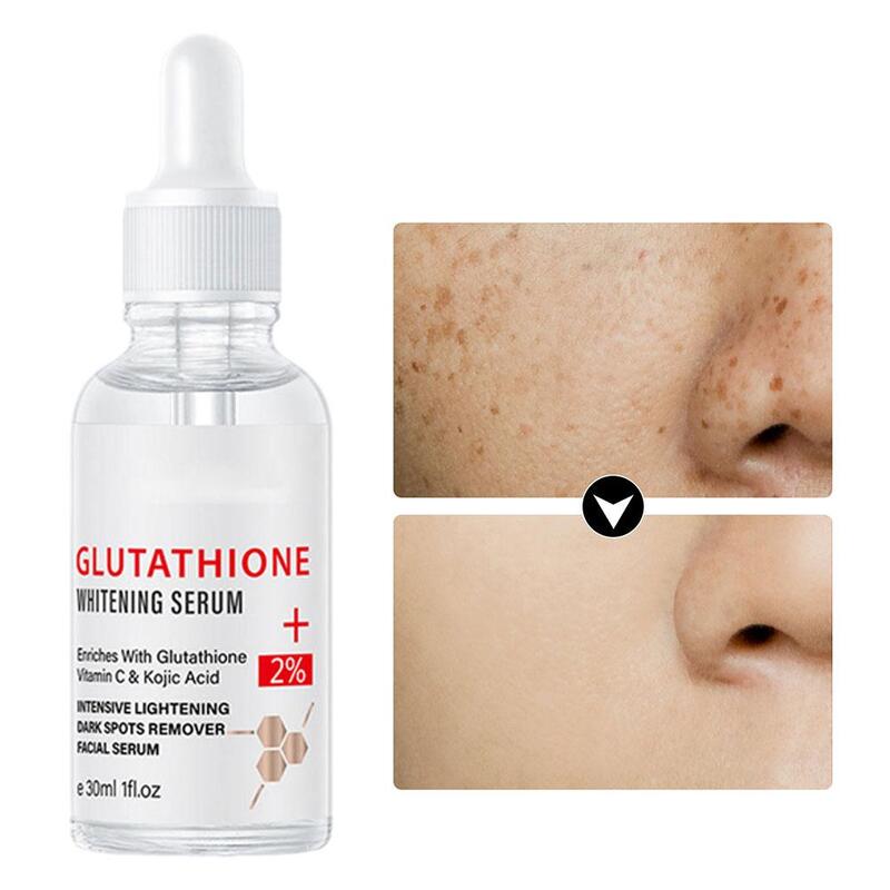 Glutationa Whitening Freckle Serum, Remover Melasma Dark Spot Face, Vitamina C Ácido Kójico Hidratante Essência