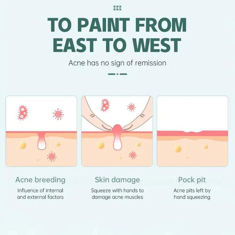 25 conteggi rosa/nero carino a forma di cuore adesivo per il trattamento dell'acne invisibile rimozione della copertura dell'acne Patch per brufoli cura della pelle