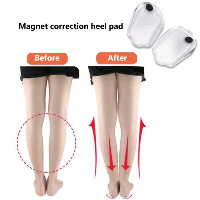 1 Pair Magnets Silicon Orthopedic Insoles Foot Care Tool For Men Women Health Care O/X Type Legs Knee Varus Correction Heel Pads