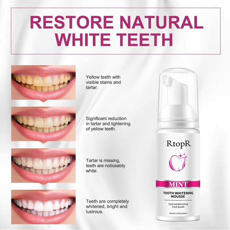 RtopR Mint Whitening Teeth Mousse Teeth Whitening Removes Dental Plaque Improves Yellow Teeth Stains Cleans Mouth Fresh Breath