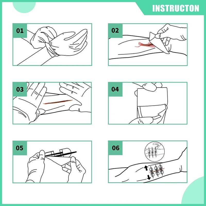 RHINO-Kit de cierre de laceración Zipstitch para el cuidado de Cortes, tiras de cierre de heridas, 6 piezas