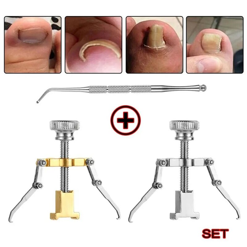 Adulto eficaz cutícula empurrador prego recuperar cuidados com os pés paronychia encravado toenail correção pedicure ferramentas conjunto