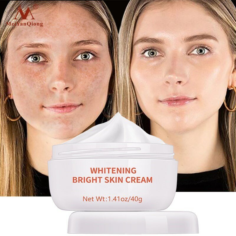 Creme clareador para o rosto, creme hidratante para remover manchas de acne, melanina, manchas escuras, reafirmante, cuidados com a pele, brilhante
