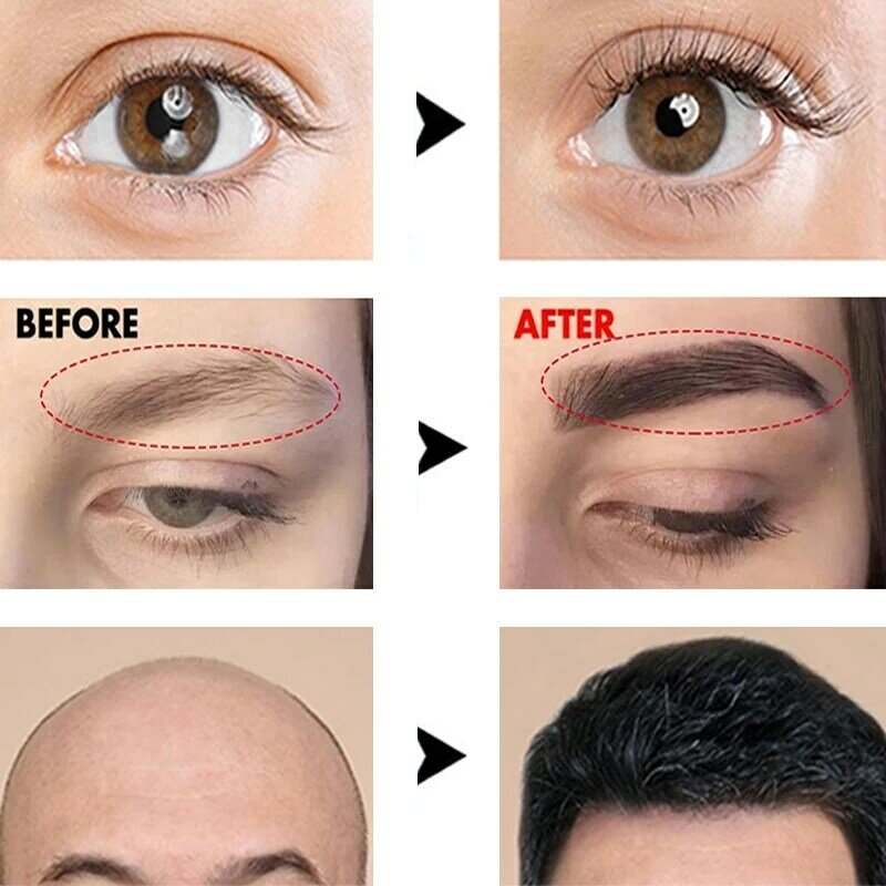 Suero de crecimiento rápido de cejas para hombres y mujeres, previene la calvicie, más completo, más grueso, alargamiento, maquillaje de cejas