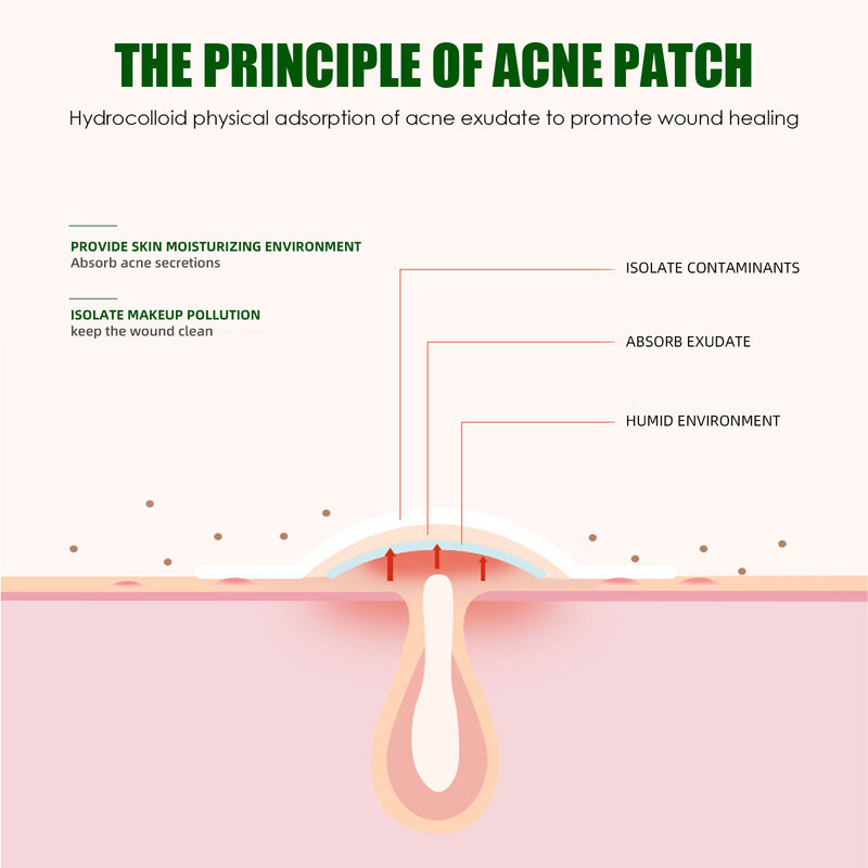 Pimple Patch para cuidados com a pele, Acne eficaz, Promove a pele saudável, Patches avançados para pele sensível, Rosto eficaz