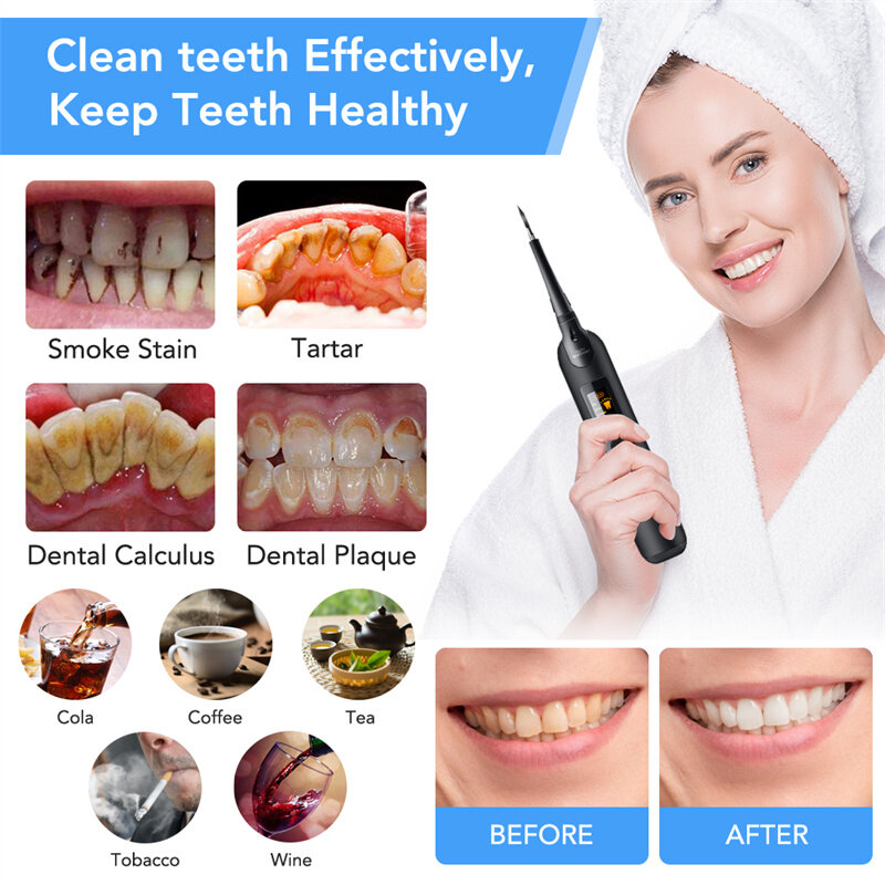 Portátil Elétrico Sonic Dental Cálculo Scaler, Oral Dentes Tártaro Removedor, Placa manchas limpador, Dentes branqueamento limpador