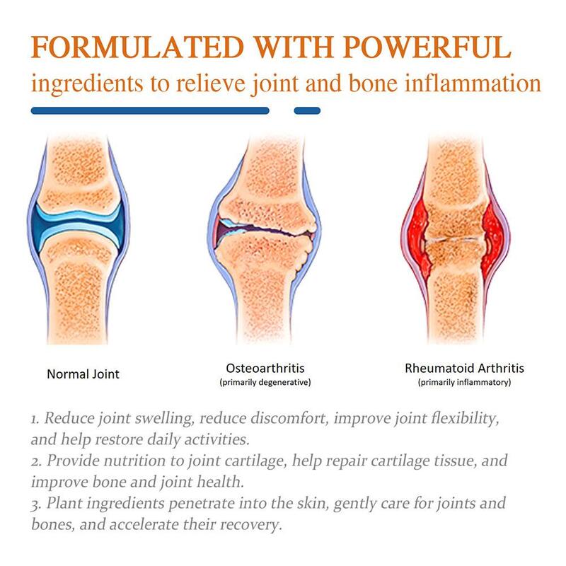 Joint Bone Honey Bee Cream Eliminates Joint Inflammation Relieves Pain Massage Reduce Joint Swelling Care Cream 59g