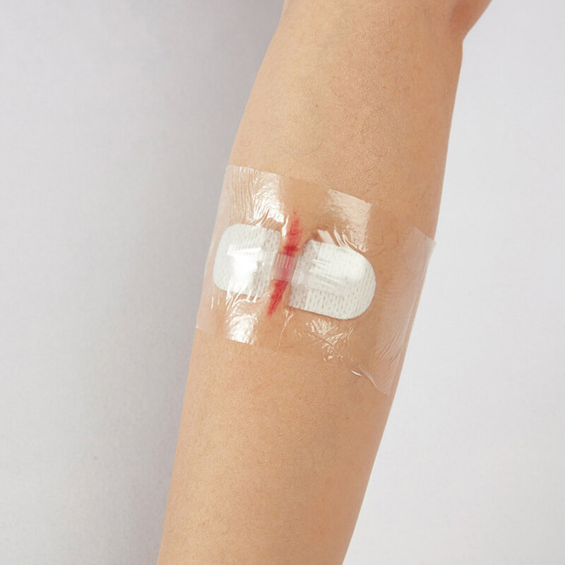 Parche de cierre de heridas con lazo de cremallera desechable, adhesivo hemostático, Kit de ayuda de emergencia, banda de laceración sin puntadas