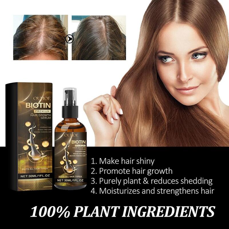 Productos de biotina para el cuidado del cabello para hombres y mujeres, aceite esencial para el crecimiento rápido del cabello, previene la caída del cabello, tratamiento del cuero cabelludo, J8R1, 30ml