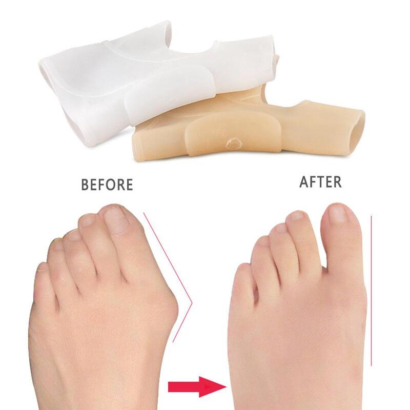 Alat perawatan kaki silikon, 1 ~ 10 buah pemisah jari kaki silikon, korektor ibu jari kaki, alat luar jari kaki