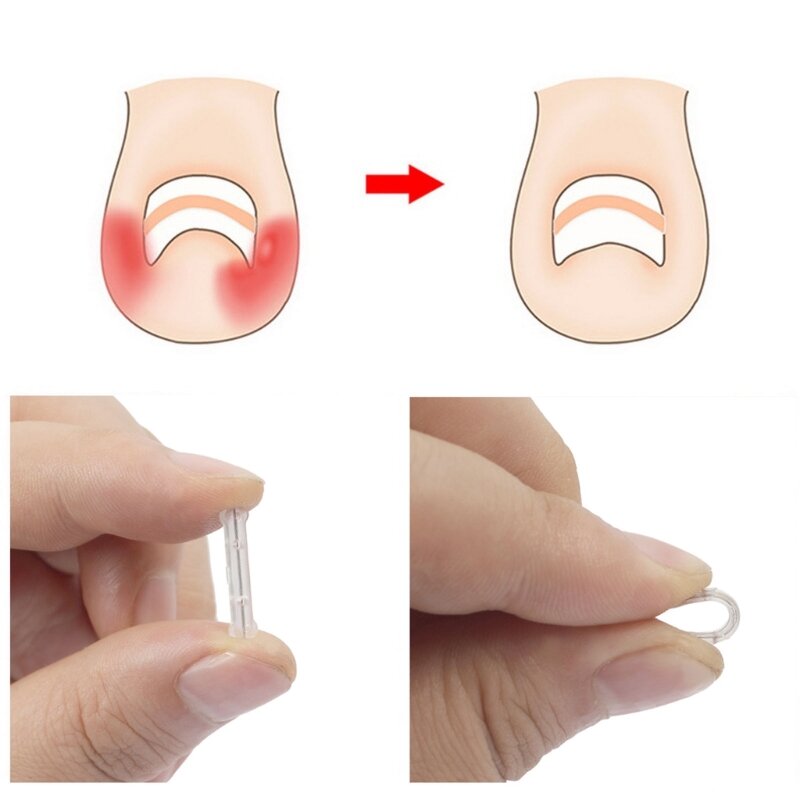 Zestaw narzędzi do pedicure na wrastające paznokcie Zestaw do pielęgnacji paznokci pilnikiem do paznokci 28ED