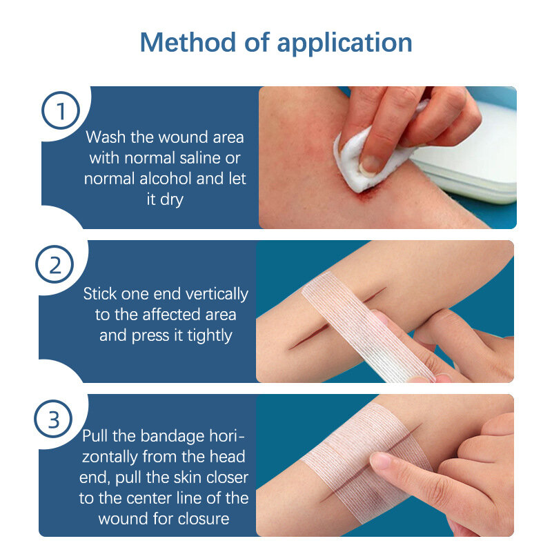 2/3/5 Strip penutup luka pita perekat steril medis perban Strip perbaikan kulit pertolongan pertama bedah Breathable Tape 10CM