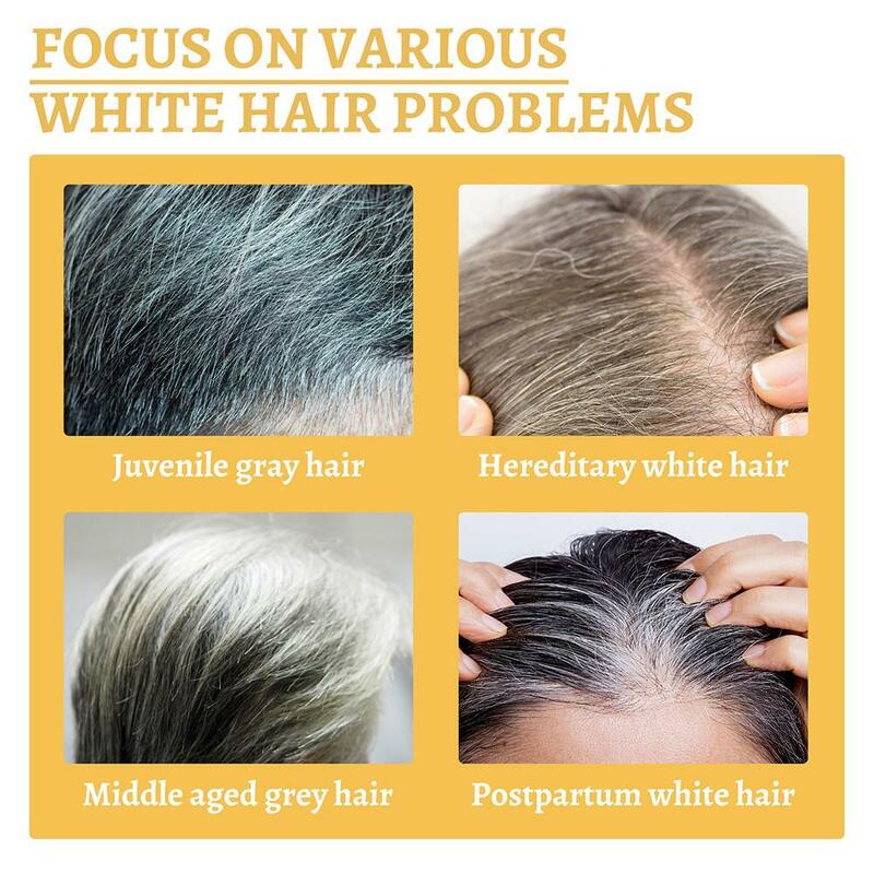 Сыворотка для лечения серых и белых волос, жидкость от белого до черного естественного цвета, восстанавливающие питательные продукты, уход за волосами против выпадения для мужчин и женщин