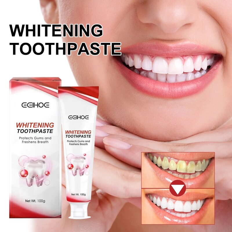 Dentifrice blanchissant pour les dents, dissolvant de calcul dentaire, élimination des odeurs de la bouche, prévention de la mauvaise haleine, parodontite, nettoyage des dents