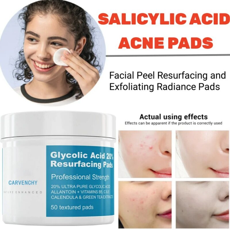 Almohadillas de ácido glicólico 20%, tratamiento Exfoliante para el acné, elimina puntos negros, reduce las líneas finas, encoge los poros, ácido salicílico