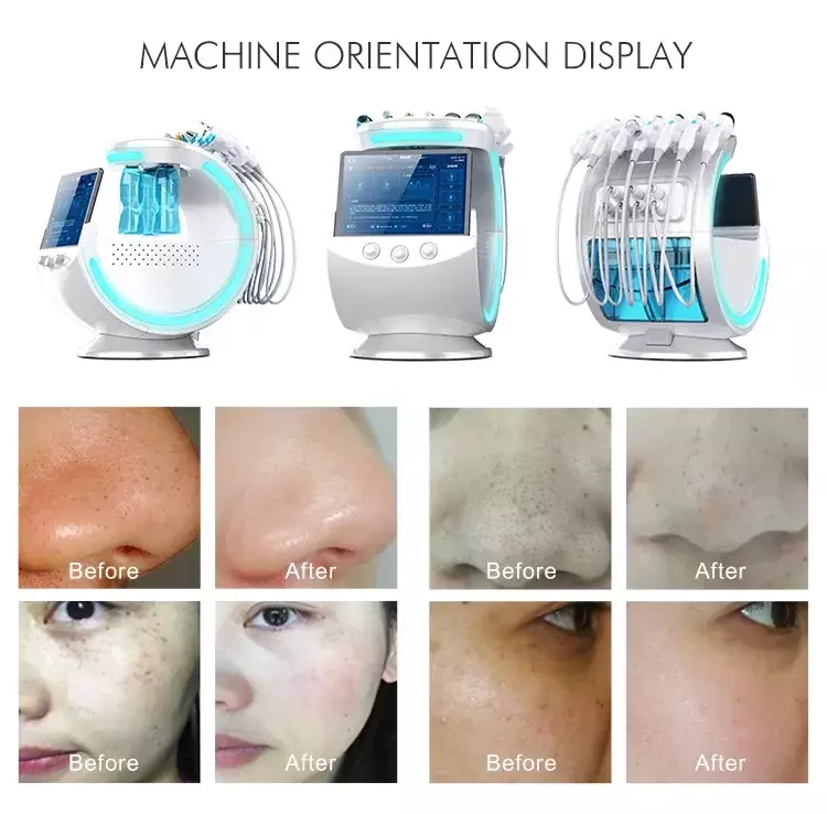 Dermoabrasão Facial Machine Máquina De Limpeza De Pele Aqua Peel RF Remoção De Rugas Limpador De Oxigênio Facial Dermoabrasão H2O2
