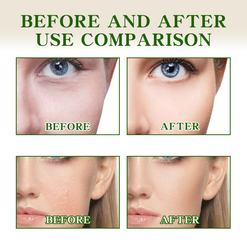 Vitamina C essenza facciale rimozione macchie scure pelle schiarire riparazione Anti-età idratante acido ialuronico dissolvenza Acne Face Lift Serum