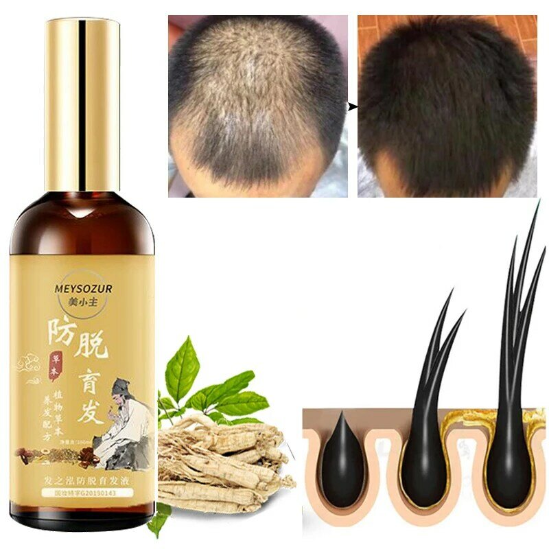 Hair Growth Serum Prevent Hair Loss Intensive Repair Promote Fast Hair Growth Strengthen Hair Deep Nourishment Hair Care 100ml