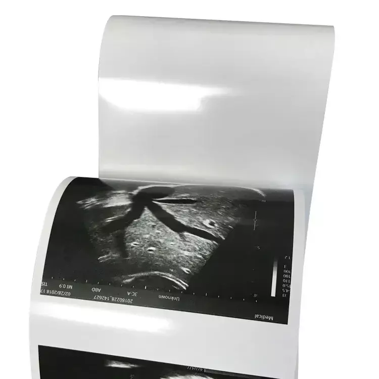 Ultrasound Printing Paper, papel térmico, compatível para Sony UPP-110HG, 110mm x 18m