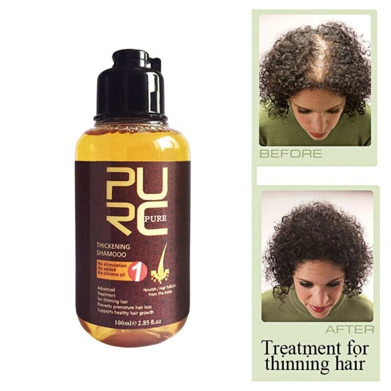 Q1QD Champú nutritivo para eliminar el cabello y la caspa para reparar el cuero cabelludo dañado 100 ml