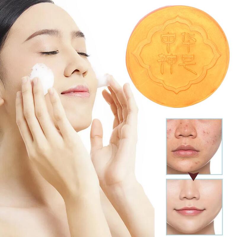 Body Whitening Soap Deep Clean Skin Chicken Skin Removal Underarm Armpit White Products Knees Brighten Soap Care Body Bleac Y1Q4
