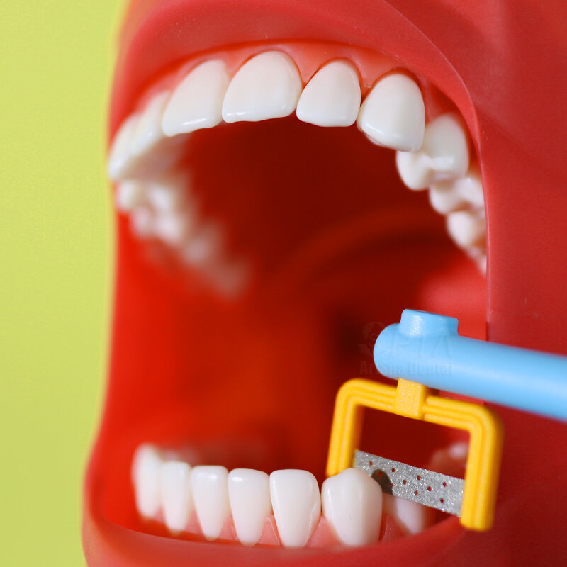 Esmalte interproximal spta dental kit de mão ipr kit alternativo de decapagem para ortodontia dentista laboratório colorido ferramentas