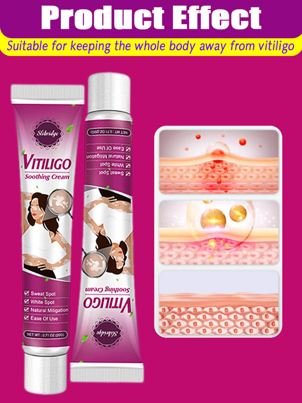Crème Vitiligo