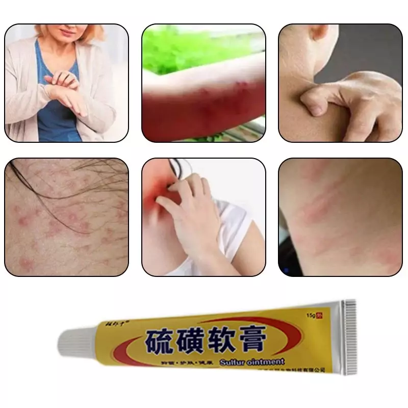 3pcsSulfur Antibacterial Cream Itching Relief Ointment Suitable for Mite Bites Dry Itchy Fungal Infection Remove Medical Plaster
