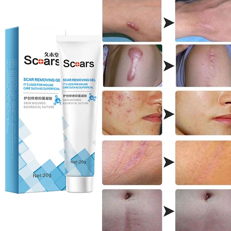 Herbal Scar Removal Cream Gel Repairing Pock Mark Burn Surgical Cesarean Scar Stretch Marks Smooth Moisturizing Skin Care