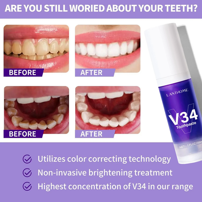 Pasta de dientes blanqueadora V34, elimina la placa, manchas de café, limpieza de higiene bucal, herramientas dentales, aliento fresco, cuidado Dental