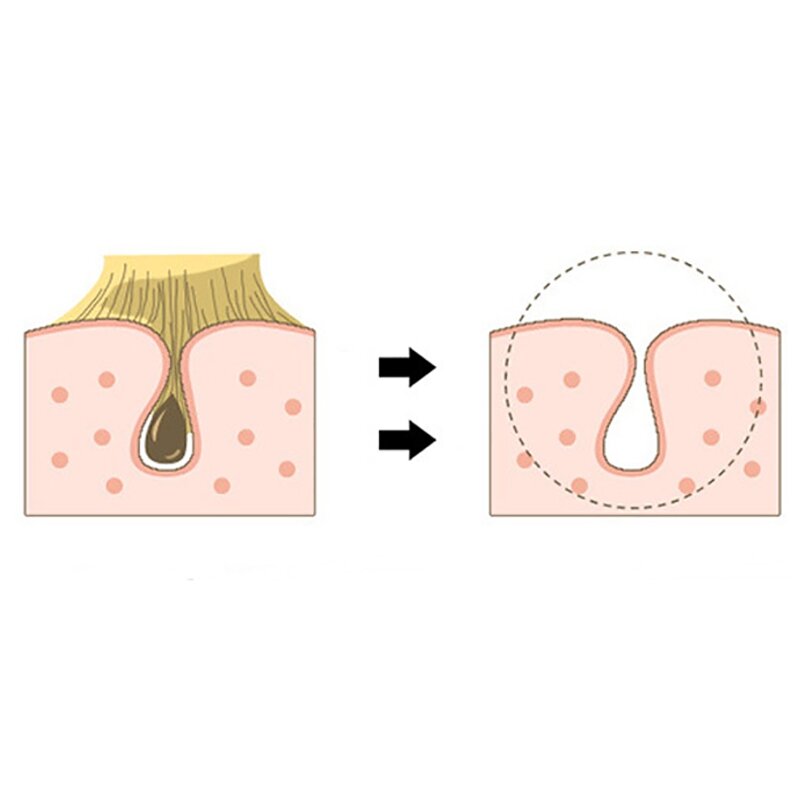 Cepillo corporal para cepillado húmedo o seco, exfoliante suave para una piel más suave y brillante, elimina la celulitis y la piel seca, 2 uds.