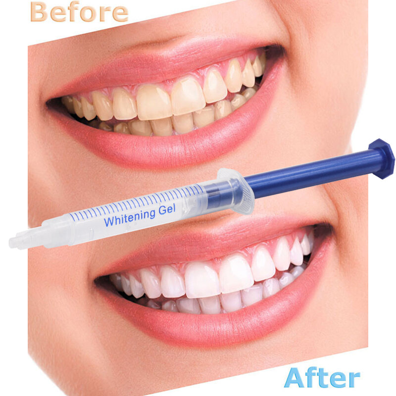 20 buah/lot Gel pemutih gigi 44% peroksida sistem pemutih gigi Kit Gel mulut pemutih gigi alat gigi Gel pemutih gigi putih