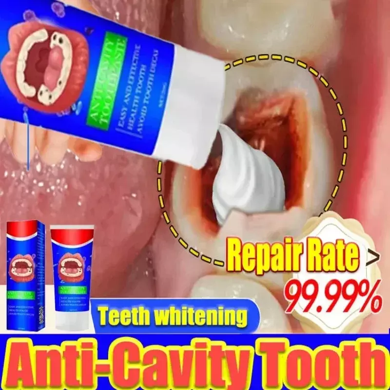 Pasta de dientes blanqueadora, reparación de decaimiento dental, anticavidad, elimina el dolor de dientes de la placa, alivia la Periodontitis