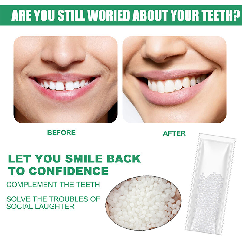 Colla per la riparazione dei denti in resina fessure dei denti modellabili riempimento colla solida riparazione temporanea dei denti colla per faldenti forniture dentali di sicurezza