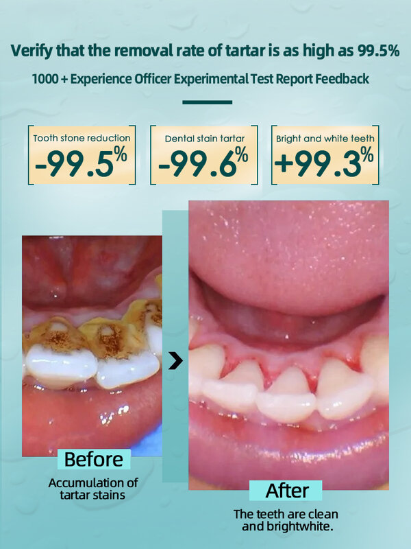 Средства для отбеливания зубов, быстрое отбеливание зубного налета, зубной пятна
