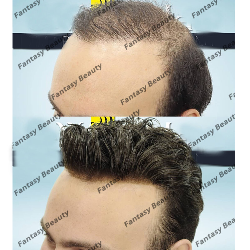 Long Lasting 100% Human Hair Men Toupee Thin Skin Durable Injected PU Base Men Hair System Prosthesis Capillary Natural Hairline
