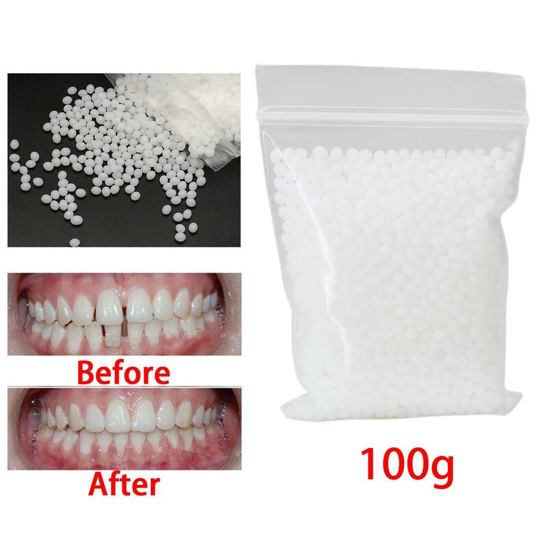 Kit de reparação dentária temporária, prótese adesiva, dentadura moldável, grandes lacunas branqueamento, 100g