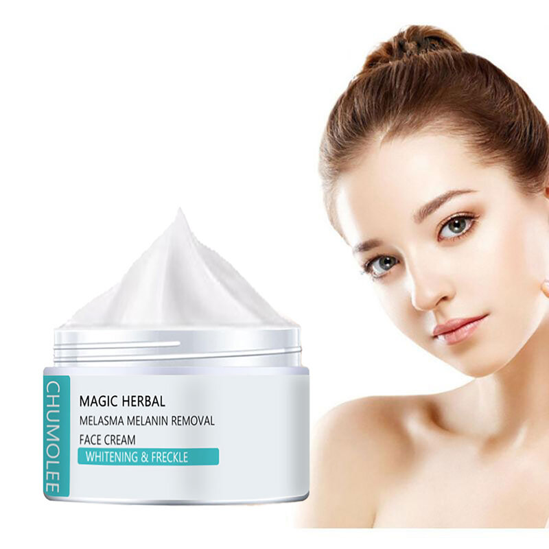 Crema blanqueadora efectiva, elimina el Melasma, pigmento de manchas de acné, pigmentación de manchas oscuras, cuidado de la piel
