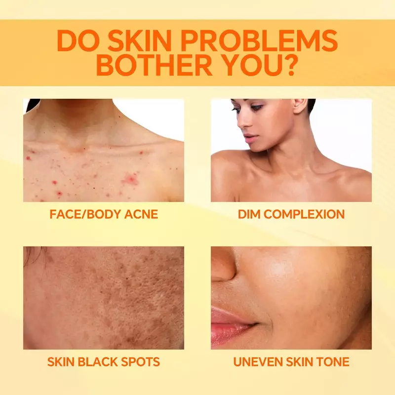 100g Kojic Acid Soap Original Papaya Soap Face Body Whitening Handmade Brighten Anti Aging Acne Remove Dark Spot Moisturizing
