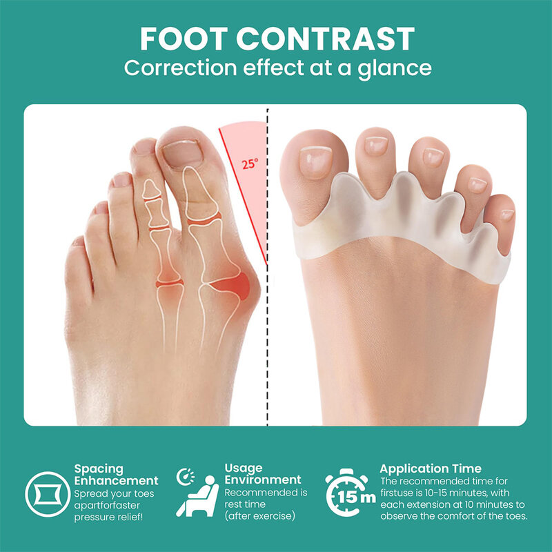 Silicone Toe Separator para Toe Separation, joanete Corrector, Hammer Toe Corrector, Material macio, Foot Care Tool, 1 par