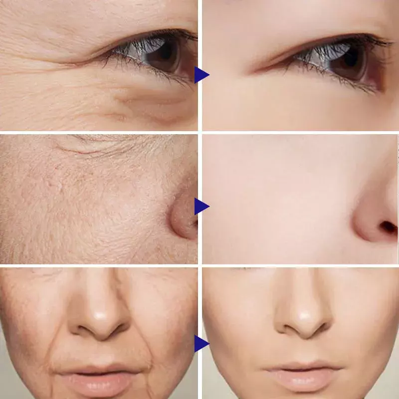 Sofort entfernen Falten creme Anti-Aging verblassen feine Linien reduzieren Falten Retinol Lifting straffende Creme Gesicht Hautpflege