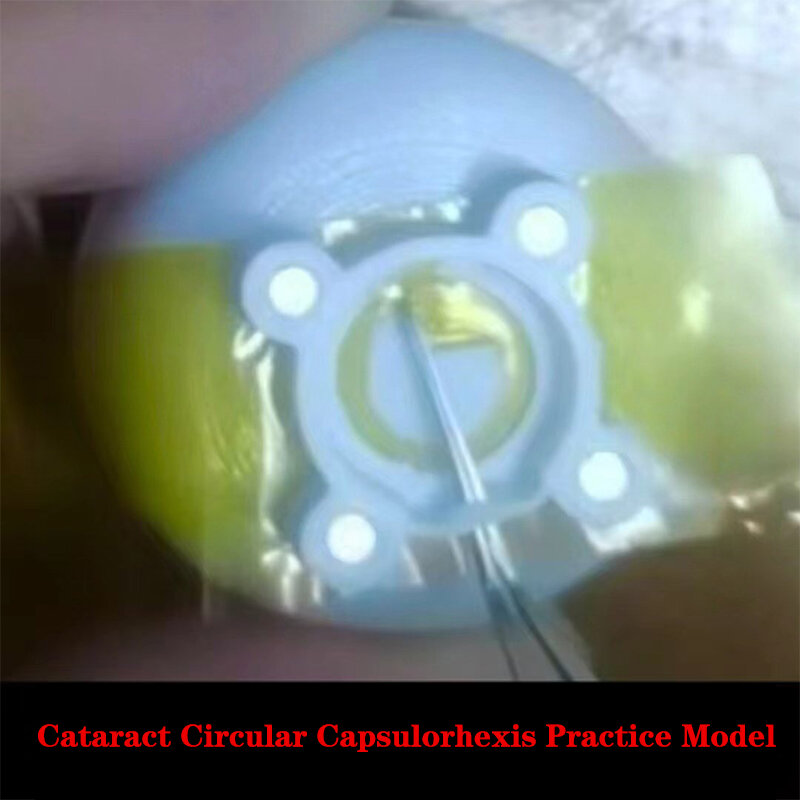 Fórceps circulares de Capsulorhexis, modelo de práctica de Oftalmología, película de 1 metro, 2,0/3,0