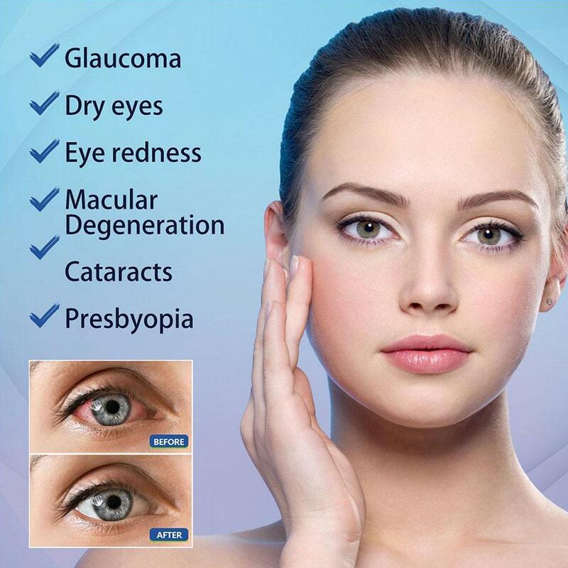 Solusi pencerah Perawatan Mata B1Y6, penghilang lelah mata kering anti-inflamasi dan melembabkan untuk perawatan mata 10ml