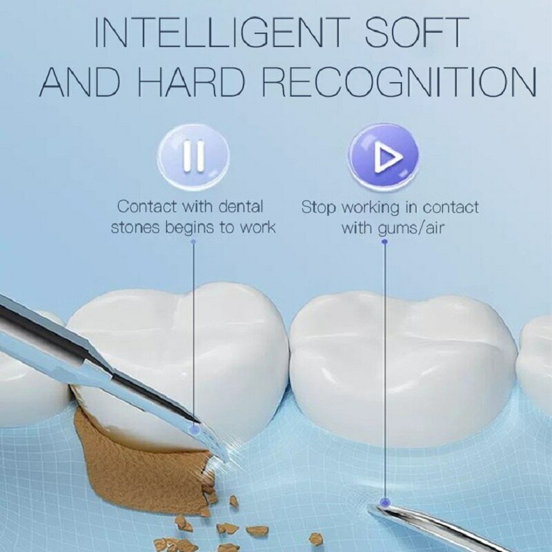 Tandheelkundige Scaler Ultrasone Scaler Tand Cleaner Tandsteen Verwijdering Elektrische Sonische Plak Remover Voor Tanden Vlek Tandsteen