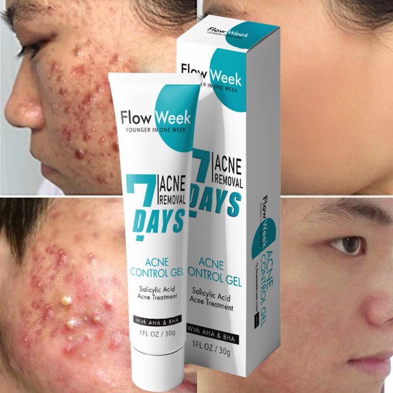Flow week acido salicilico trattamento dell'acne Gel Tea Tree brufolo rimozione macchie crema viso crema sbiancante Anti-Acne cura della pelle