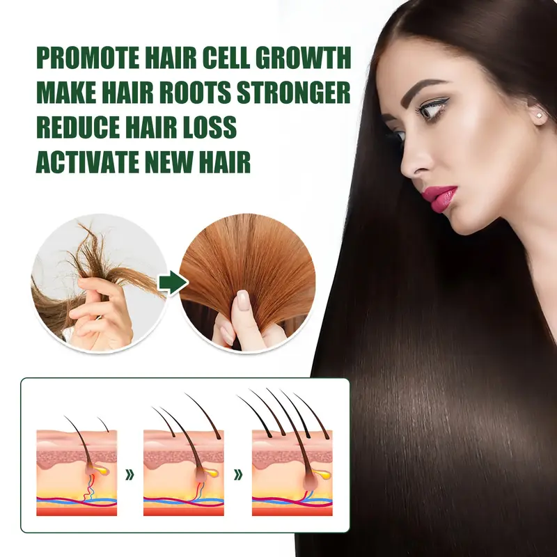 Huile essentielle anti-chute de cheveux naturelle, croissance rapide des cheveux, prévention de la calvitie, traitement rapide, nourrit les cheveux secs et abîmés, vidéo en 5 jours